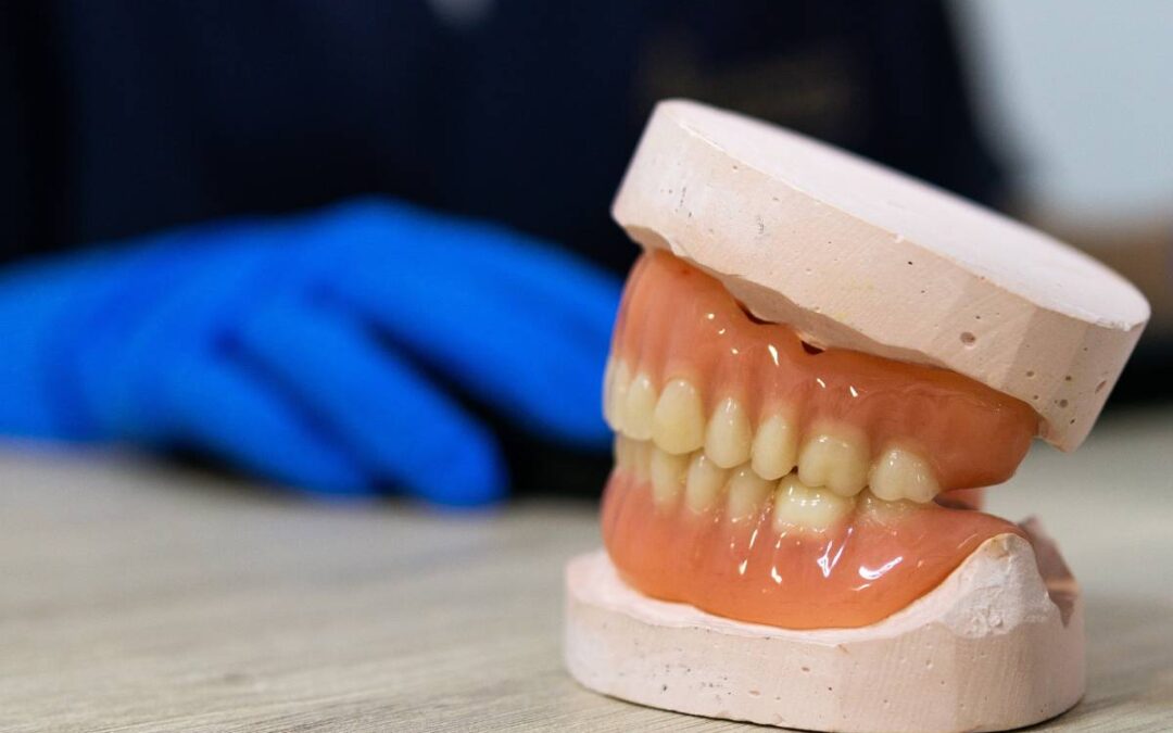 Signs Your Dentures Need a Reline: Loose Denture & Sore Spots