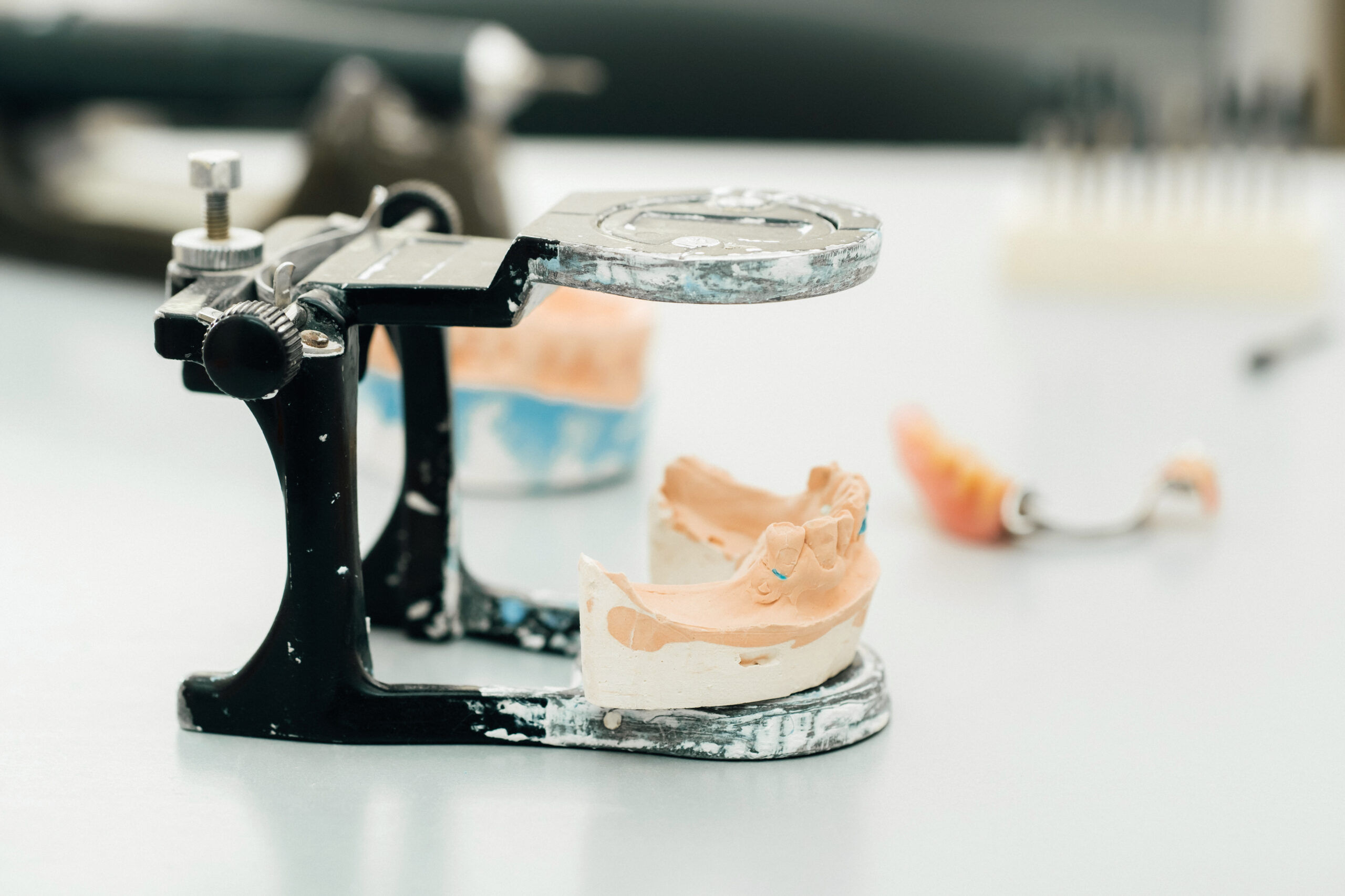 Model of teeth made of plaster of the jaw for dental technicians Soft Reline vs Hard Reline
