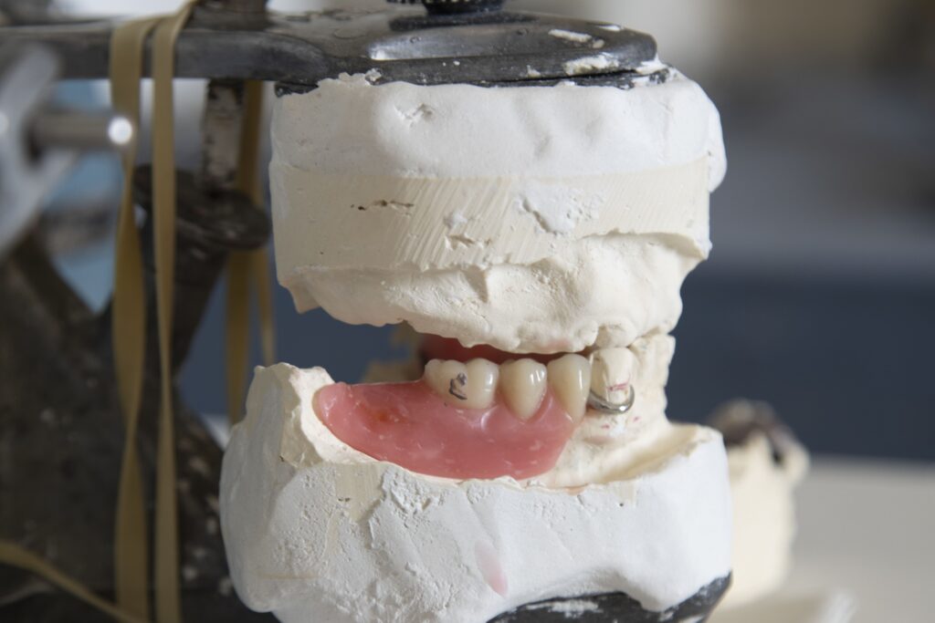Soft Reline vs Hard Reline Denture
