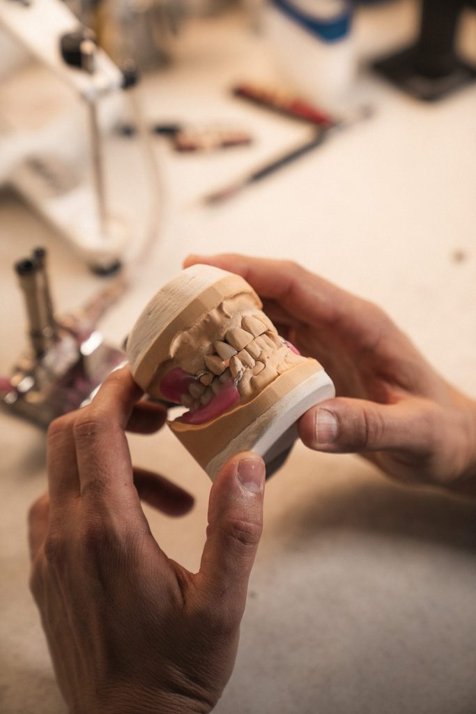 The full denture process
