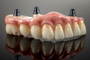 Implant-Supported Dentures in Brisbane: A Complete Guide to Your Options